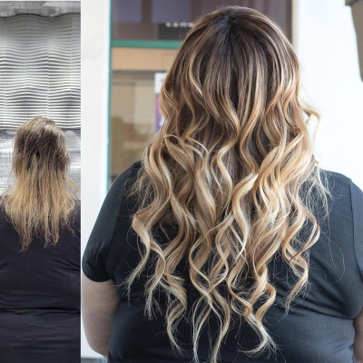 November-Crown-Fusion-Before-After-ALL1x1-BA-Back