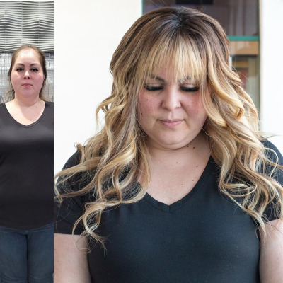 November-Crown-Fusion-Before-After-ALL1x1-BA-Front