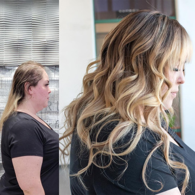 November-Crown-Fusion-Before-After-ALL1x1-BA-Right