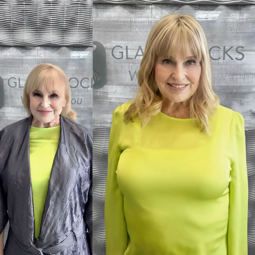 Crown Fusion before and after - right