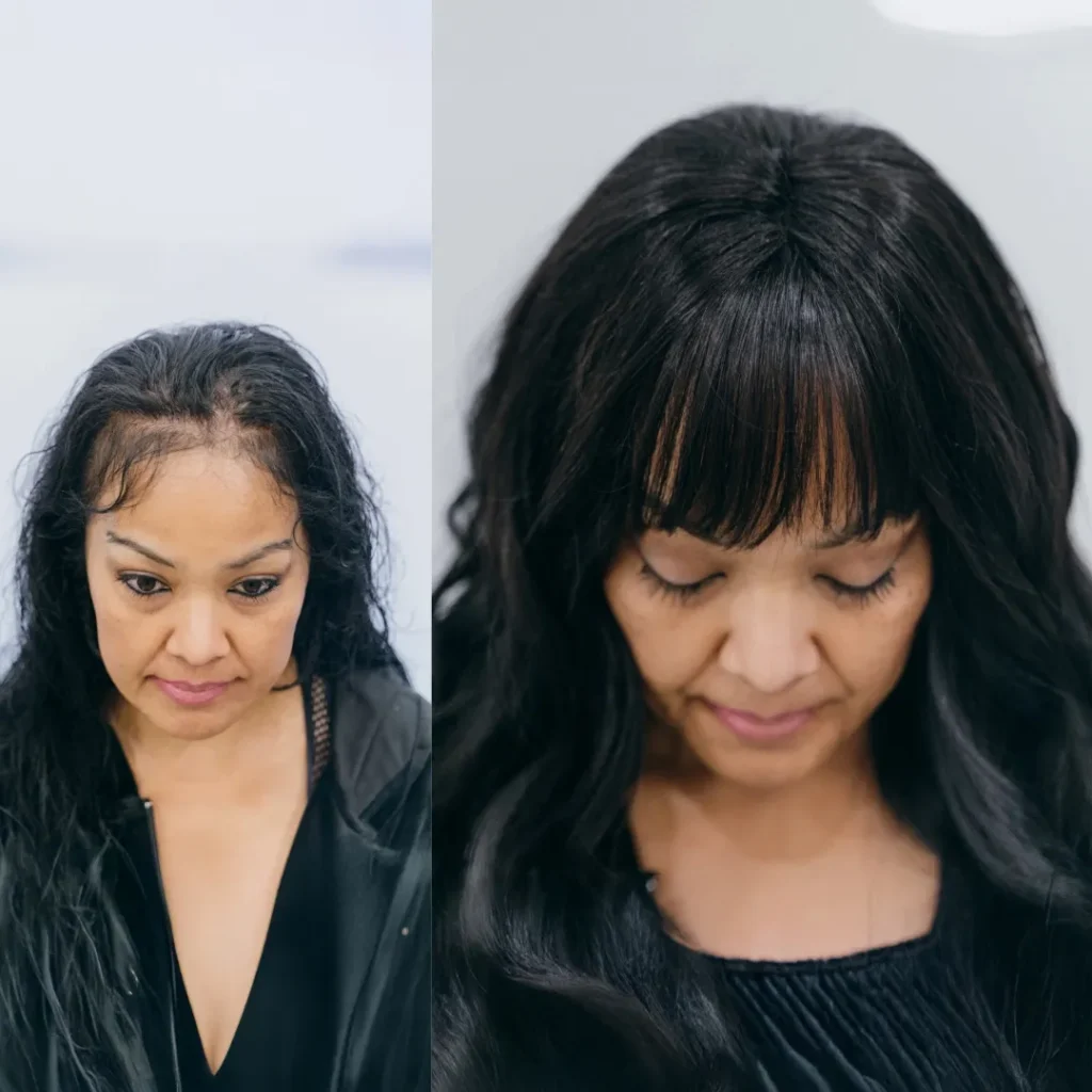 Crown Fusion Hair Topper For Course Straight Hair - Top Angle